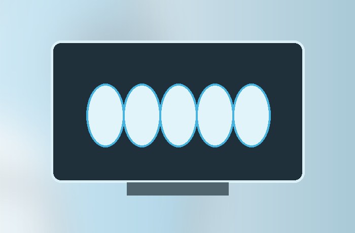 Beispielbild digitale Zahntechnik