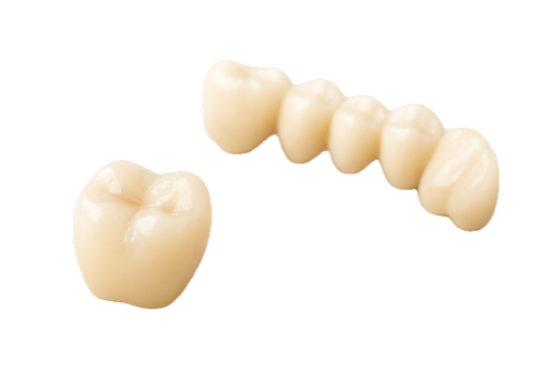 Beispielbild Implantatprothetik